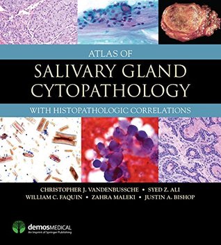 Read Online Atlas of Salivary Gland Cytopathology: with Histopathologic Correlations - Christopher J. VandenBussche | ePub